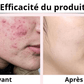 Tampons Exfoliants Curcuma & Acide Kojic