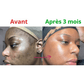 Tampons Exfoliants Curcuma & Acide Kojic