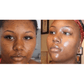 Tampons Exfoliants Curcuma & Acide Kojic